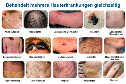 Natravor® Black Rice Skin Repair Essence Cream ⚕️ FDA Certified (Removes warts and skin growths, improves keratin buildup and seborrheic dermatitis, follicular keratosis, age spots, and bruising)