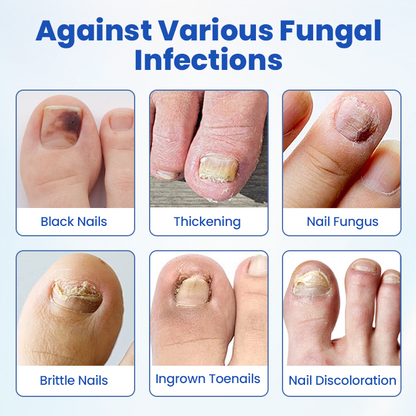 FungalPatch - Antibacterial Fungal Patch
