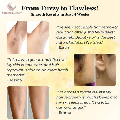 Cyperus Rotundus Oil for Natural Permanent Hair Reduction