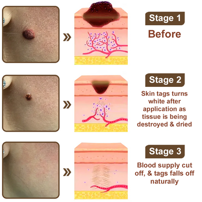 Natravor® Black Rice Skin Repair Essence Cream ⚕️ FDA Certified (Removes warts and skin growths, improves keratin buildup and seborrheic dermatitis, follicular keratosis, age spots, and bruising)